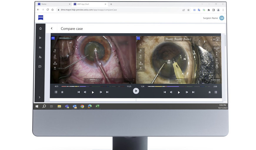 ZEISS innovation paves way to more personalized patient care with cutting-edge AI technology
